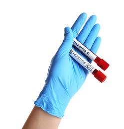 Scientist holding tubes with blood samples for hepatitis virus test on white background, closeup