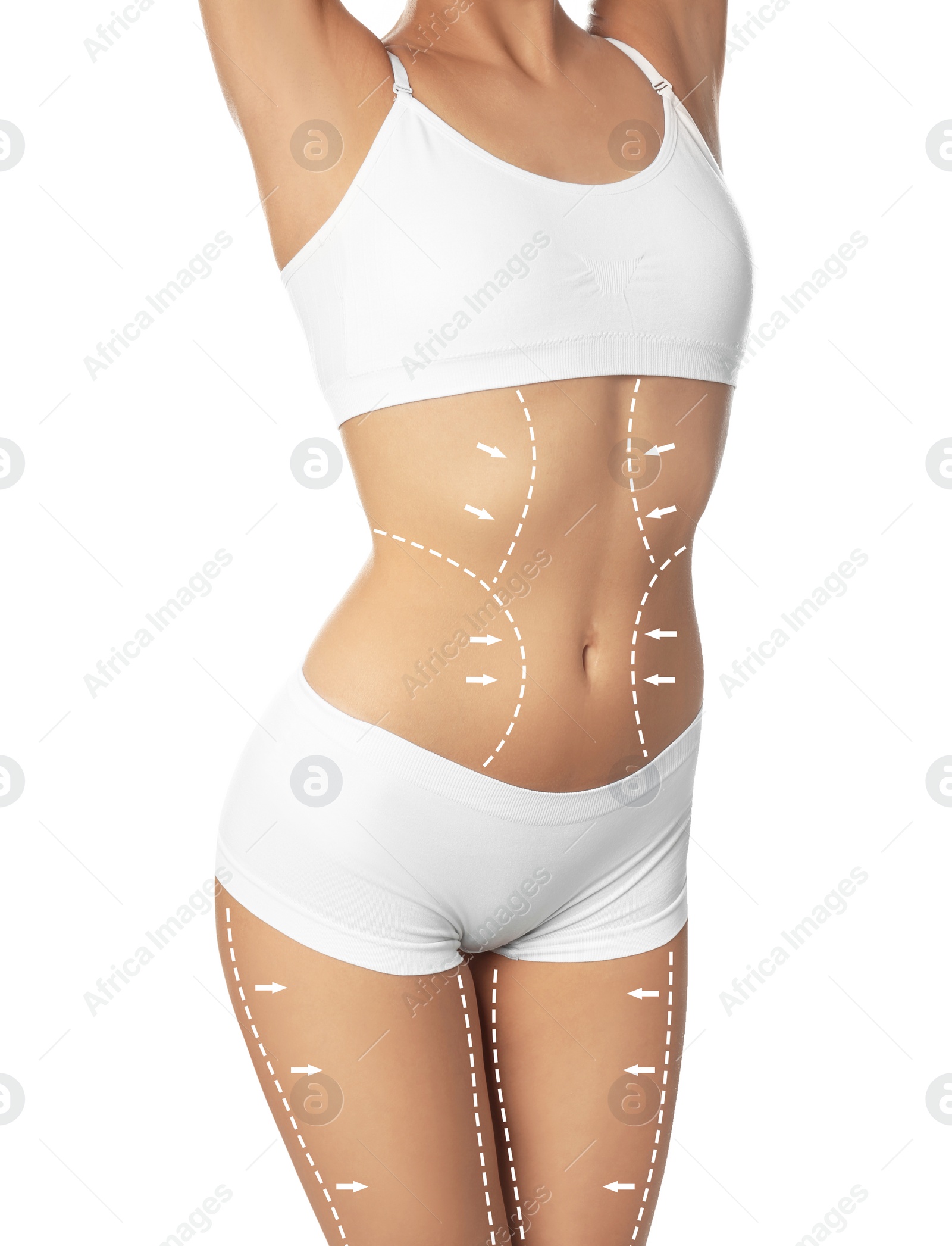 Image of Slim young woman with marks on body for cosmetic surgery operation against white background, closeup