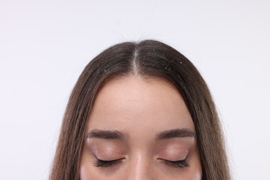 Woman with dandruff problem on white background, closeup