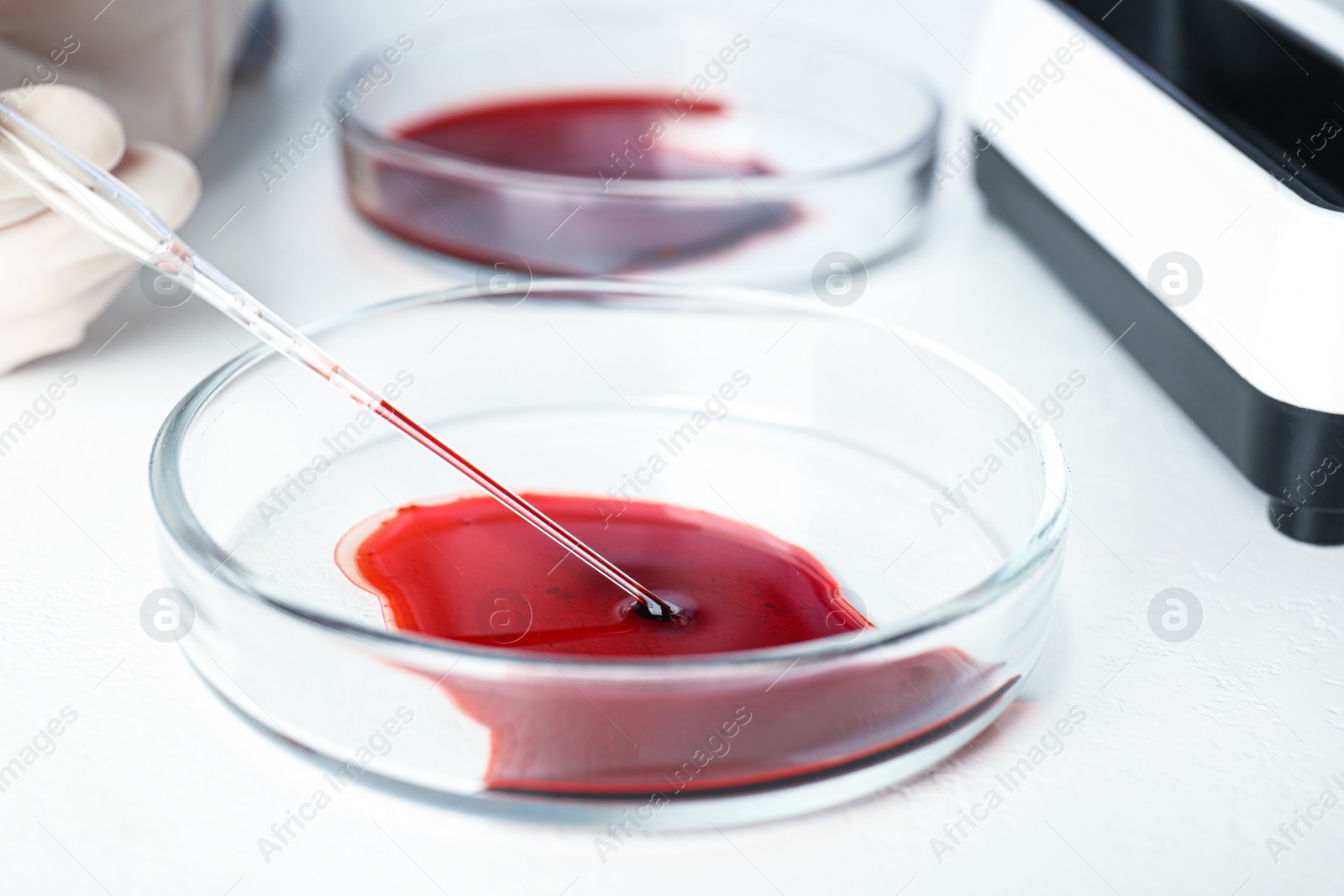 Photo of Scientist taking blood sample from Petri dish with pipette in laboratory, closeup. Virus research