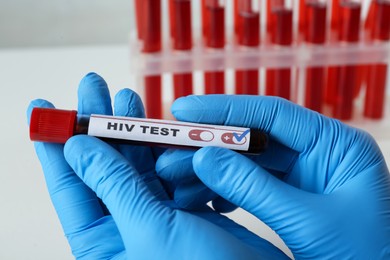 Photo of Scientist holding tube with blood sample and label HIV Test at table, closeup