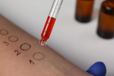 Photo of Patient undergoing skin allergy test at light table in clinic, closeup