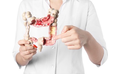 Photo of Doctor showing model of large intestine on white background, closeup