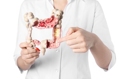 Doctor showing model of large intestine on white background, closeup