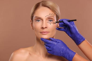Image of Woman preparing for cosmetic surgery, light brown background. Doctor drawing markings on her face, closeup