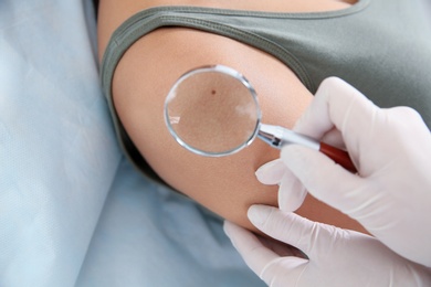 Dermatologist examining patient's birthmark with magnifying glass in clinic, closeup