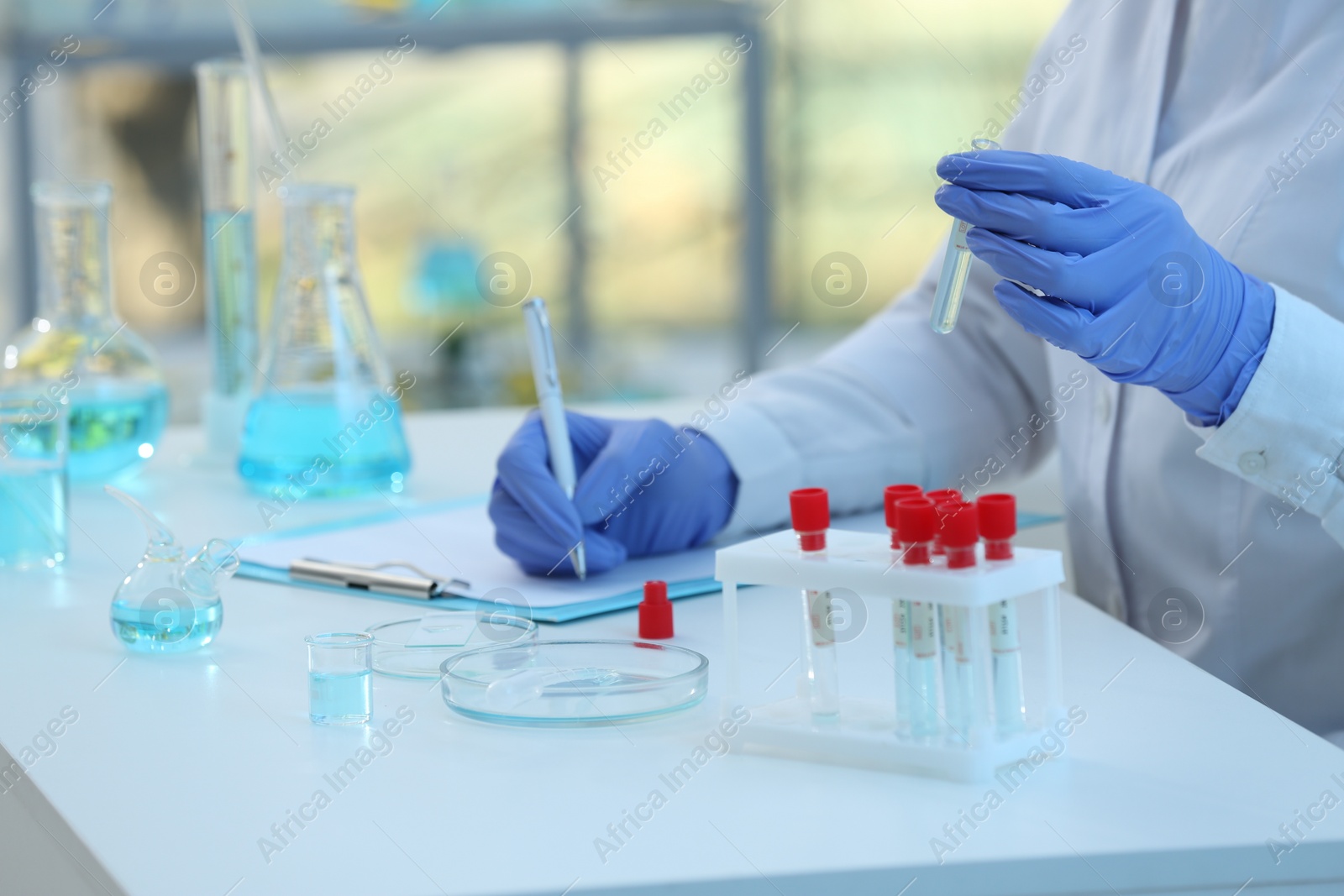 Photo of Scientist working with sample in laboratory, closeup. Medical research