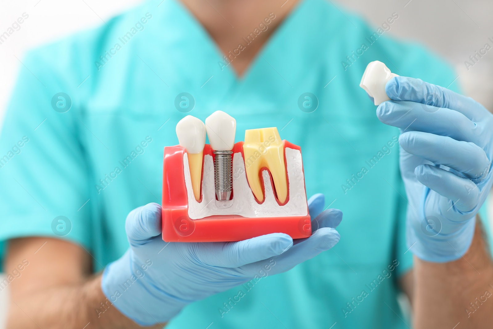 Photo of Dentist holding educational model of dental implant on blurred background, closeup