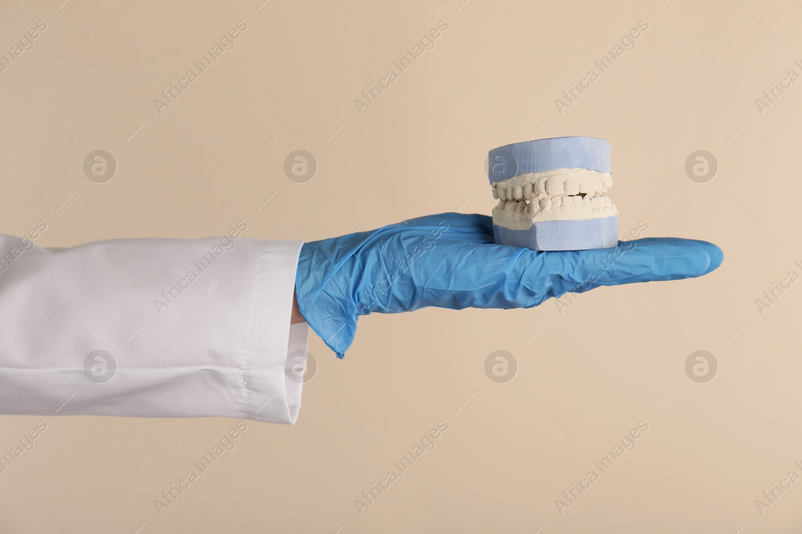 Photo of Doctor holding dental model with jaws on beige background, closeup. Cast of teeth