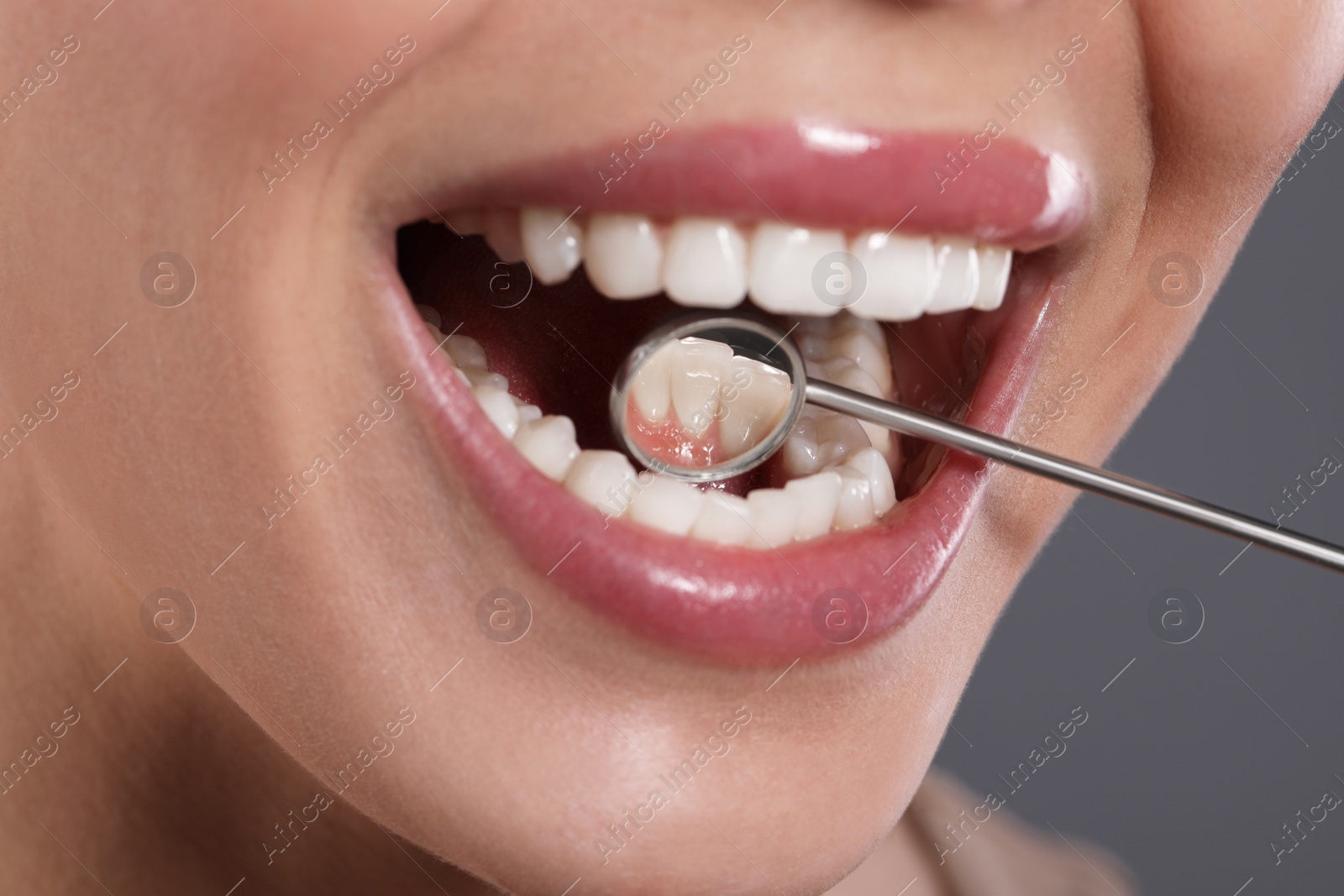 Photo of Examining woman's teeth with dentist's mirror on grey background, closeup