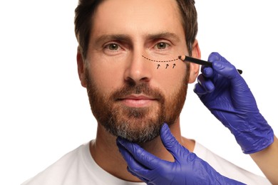 Man preparing for cosmetic surgery, white background. Doctor drawing markings on his face, closeup