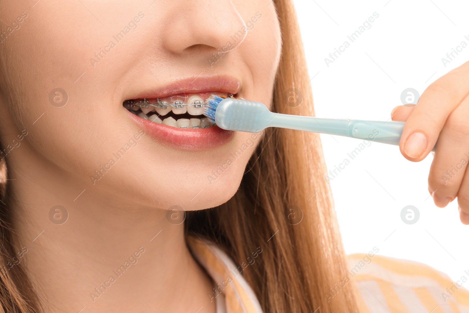 Photo of Smiling woman with dental braces cleaning teeth on white background, closeup