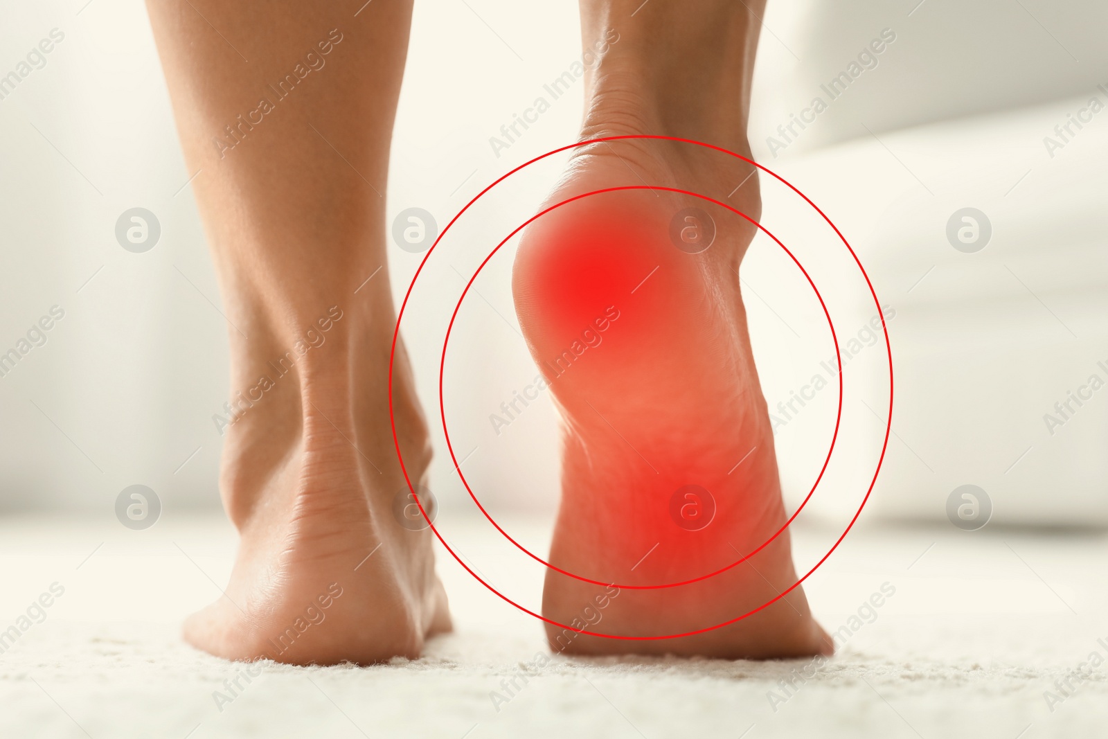 Image of Woman suffering from foot pain at home, closeup 