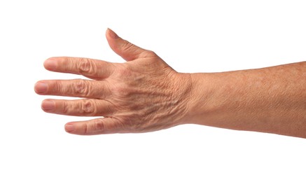 Photo of Closeup view of woman's hand with aging skin