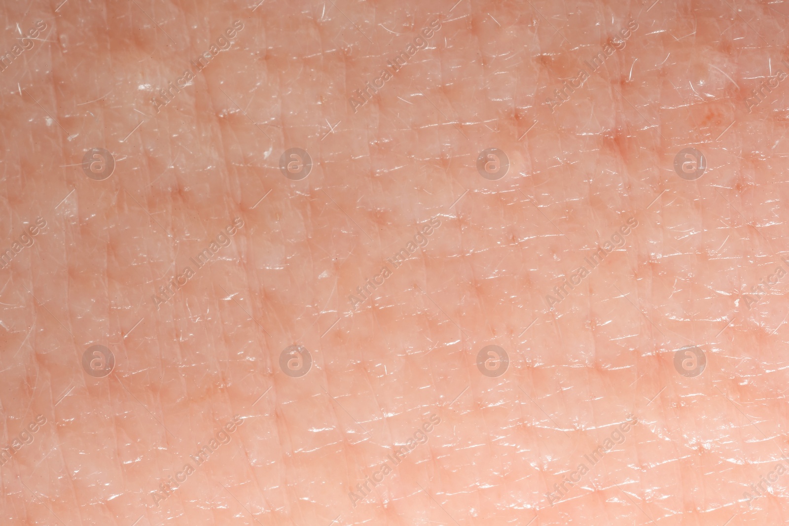 Photo of Texture of dry skin as background, macro view