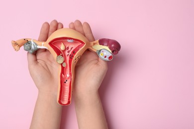 Photo of Woman with anatomical model of uterus on pink background, top view and space for text. Gynecology concept