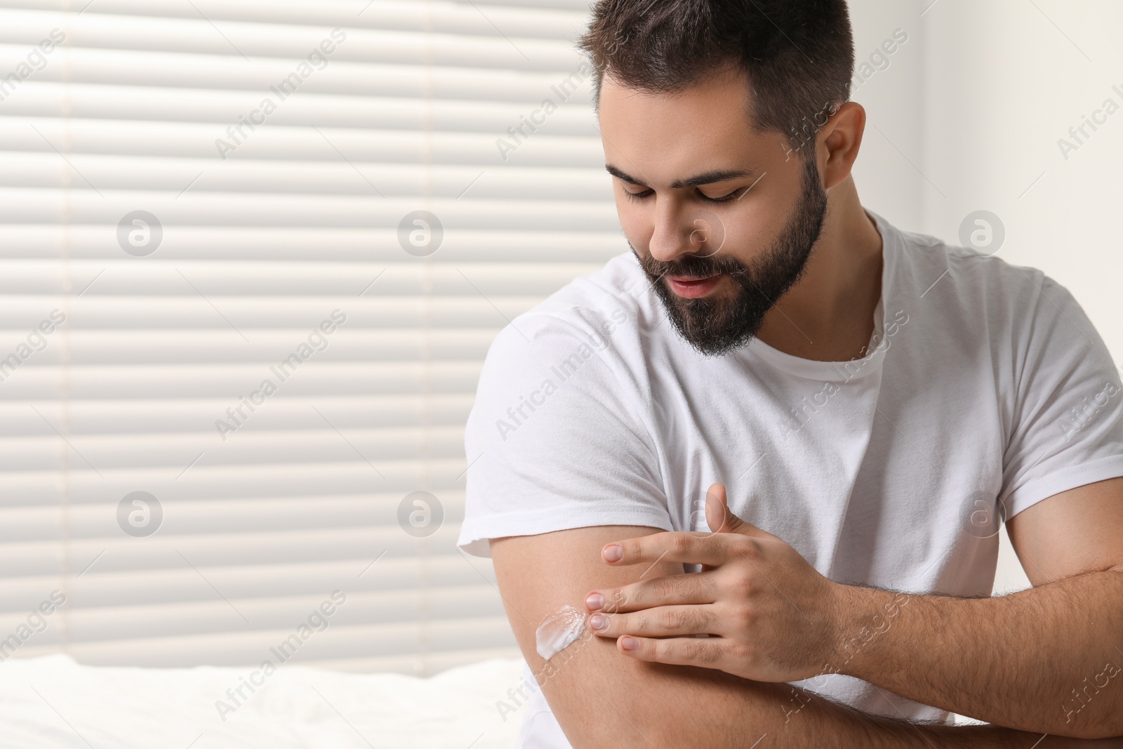 Photo of Man with dry skin applying cream onto his arm indoors, space for text