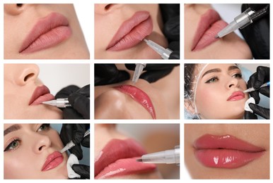 Image of Collage with different photos of women undergoing permanent lip makeup