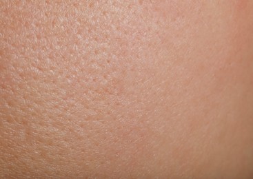 Photo of Closeup view of human skin as background