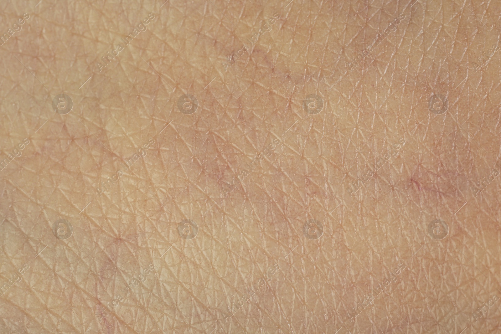 Photo of Texture of healthy skin as background, macro view