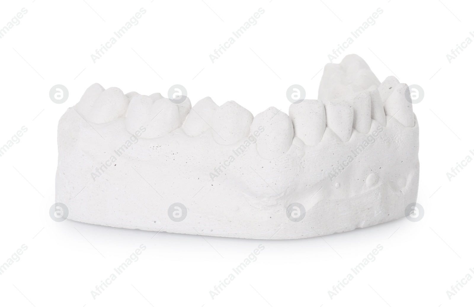 Photo of Dental model with gum isolated on white. Cast of teeth