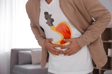 Man suffering from heartburn at home, closeup. Stomach with fire and smoke symbolizing acid indigestion, illustration