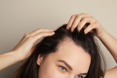 Photo of Woman suffering from baldness on grey background, closeup