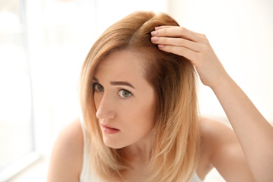 Young woman with hair loss problem on light background