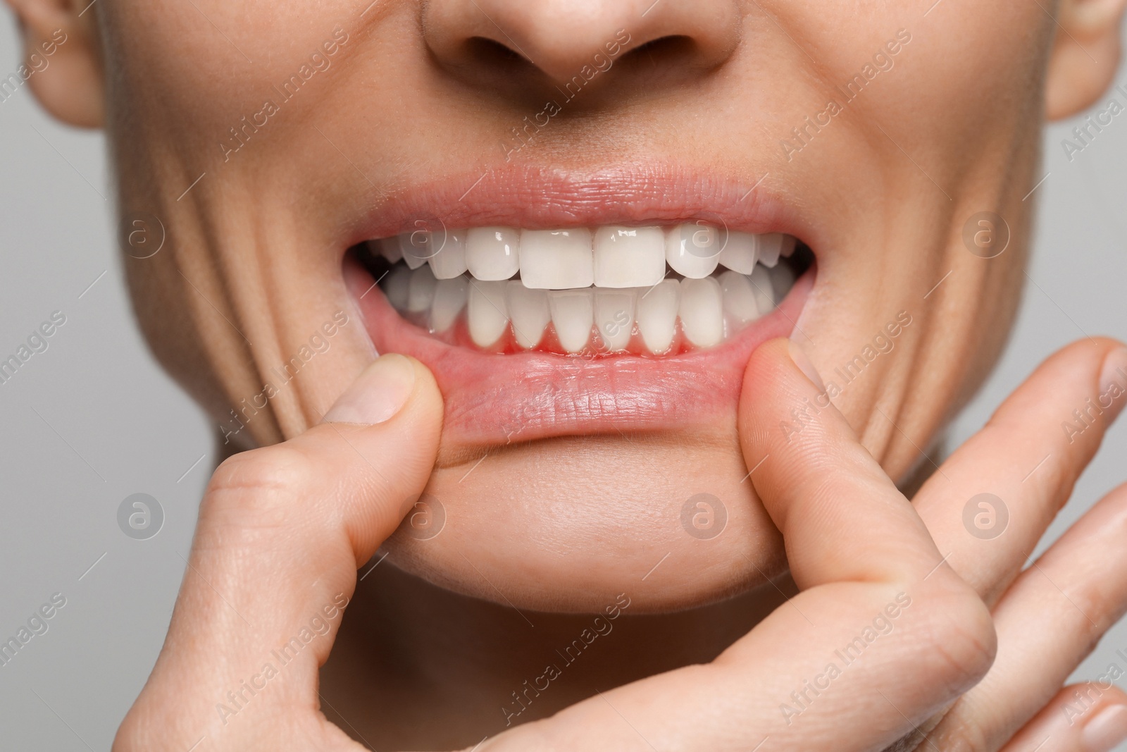 Image of Woman showing inflamed gum on grey background, closeup