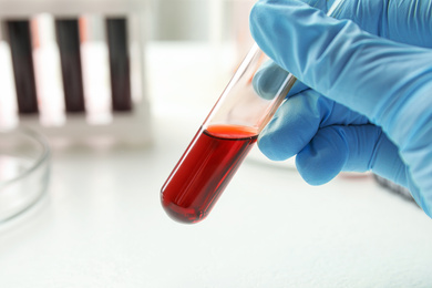 Image of Scientist holding test tube with blood sample, closeup. Laboratory analysis