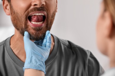Photo of Doctor in medical gloves examining man`s oral cavity on blurred background, closeup