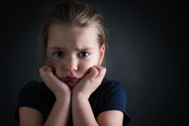 Photo of Little girl with bruises on face against dark background, space for text. Domestic violence victim