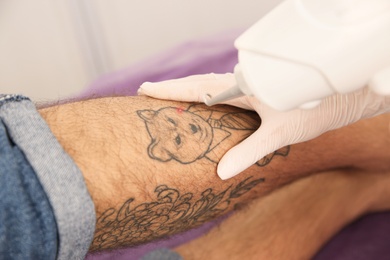 Photo of Young man undergoing laser tattoo removal procedure in salon, closeup