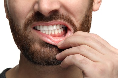 Photo of Man showing his healthy teeth and gums on white background, closeup