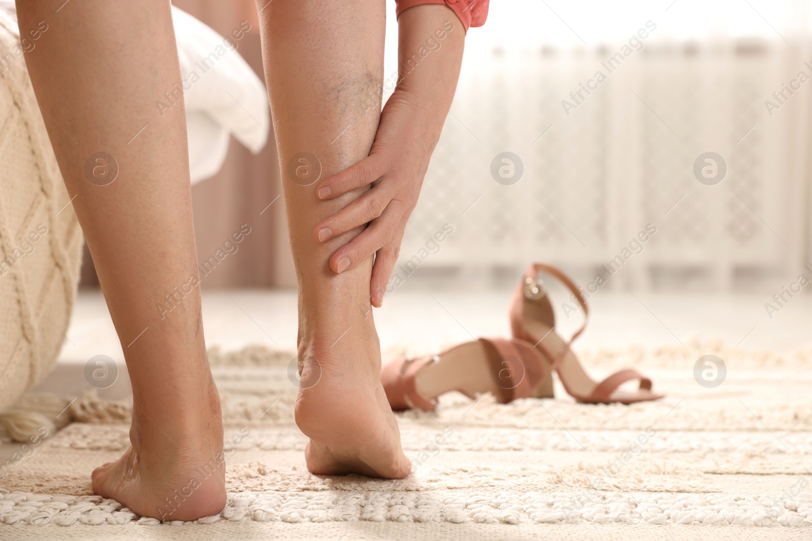 Photo of Barefoot woman with varicose veins at home, closeup. Space for text