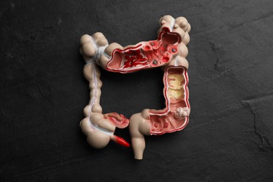 Human colon model on black table, top view
