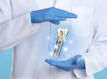 Doctor demonstrating virtual model of dental implant on light blue background, closeup