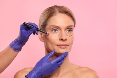 Photo of Doctor with marker preparing patient for cosmetic surgery operation on pink background