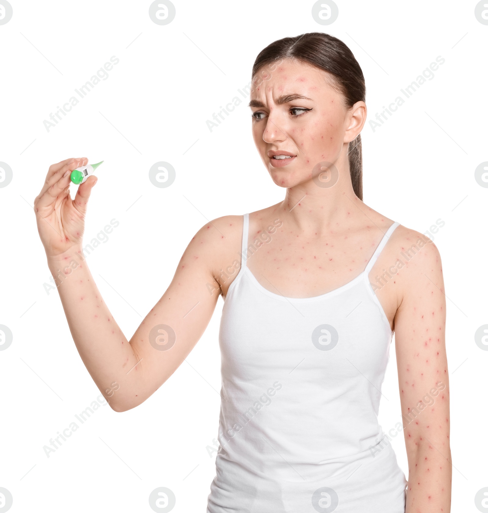 Photo of Woman with rash holding thermometer on white background. Monkeypox virus