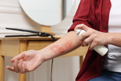 Woman applying panthenol onto burns on her hand indoors, closeup