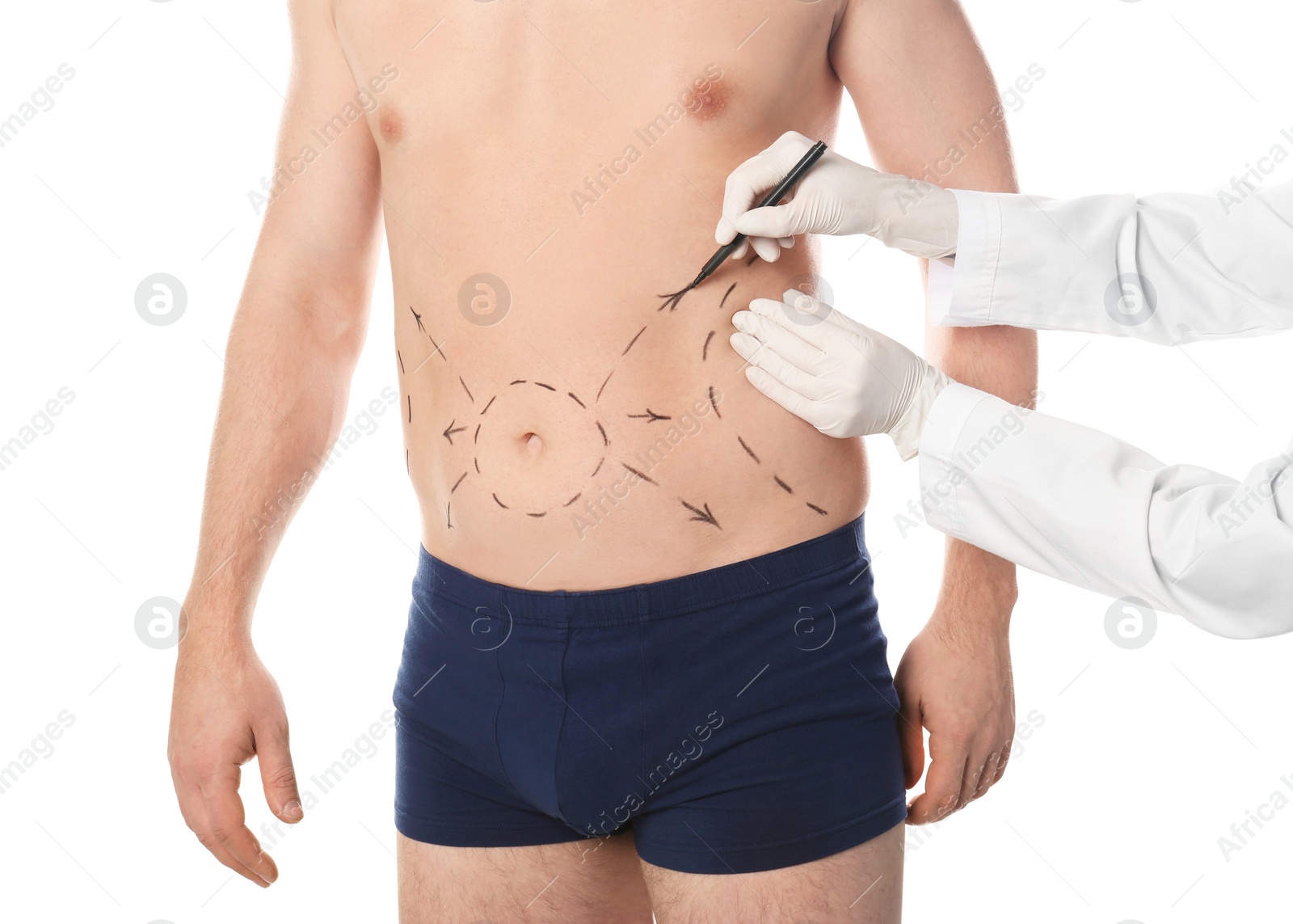 Photo of Doctor drawing marks on man's body for cosmetic surgery operation against white background, closeup