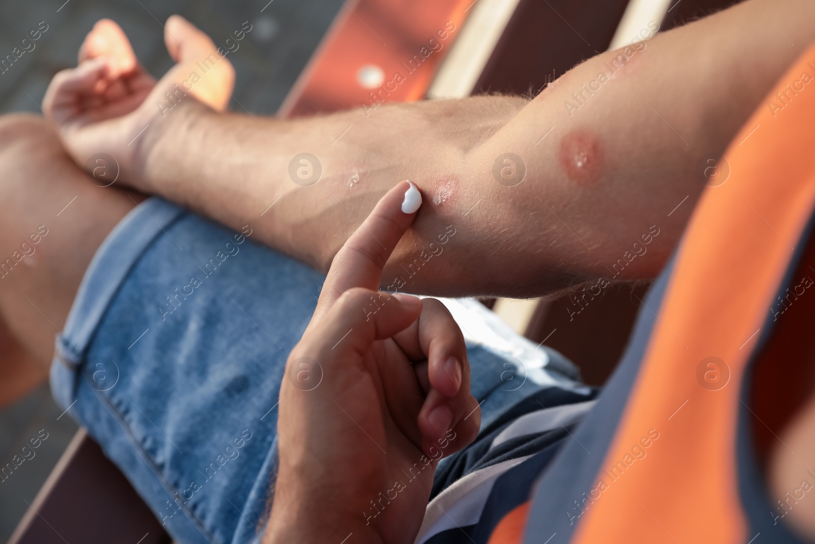 Photo of Man applying insect repellent cream on his arm outdoors, closeup