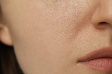 Photo of Macro view of woman with dry skin