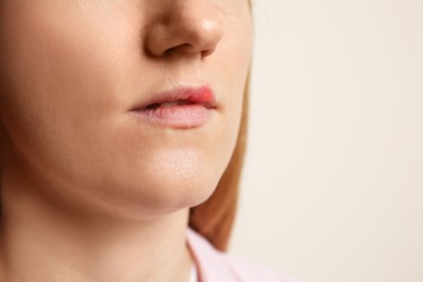 Woman suffering from herpes on beige background, closeup. Space for text