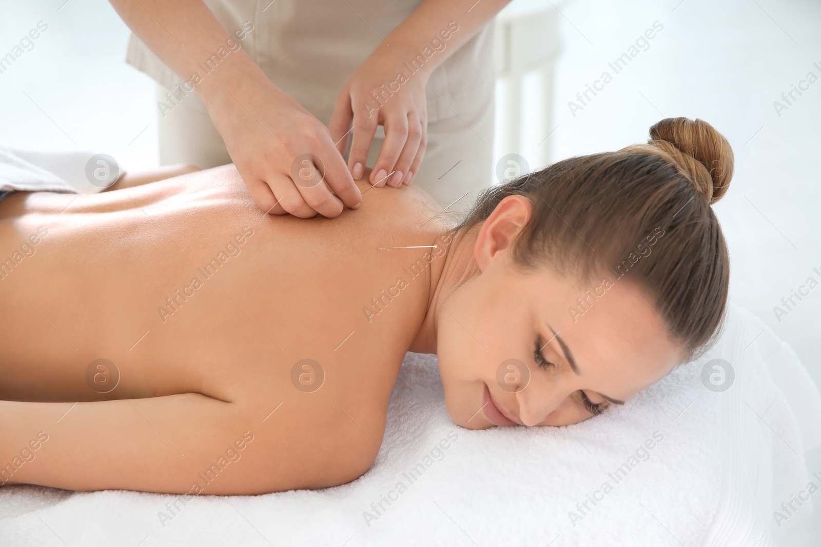 Photo of Young woman undergoing acupuncture treatment in salon