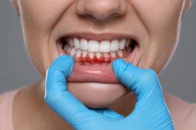 Doctor examining woman's inflamed gum on grey background, closeup