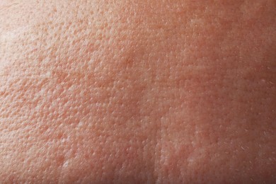 Photo of Closeup view of human skin as background