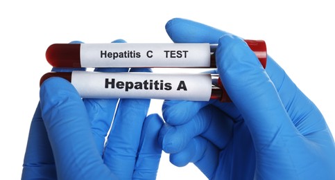 Scientist holding tubes with blood samples for hepatitis virus test on white background, closeup