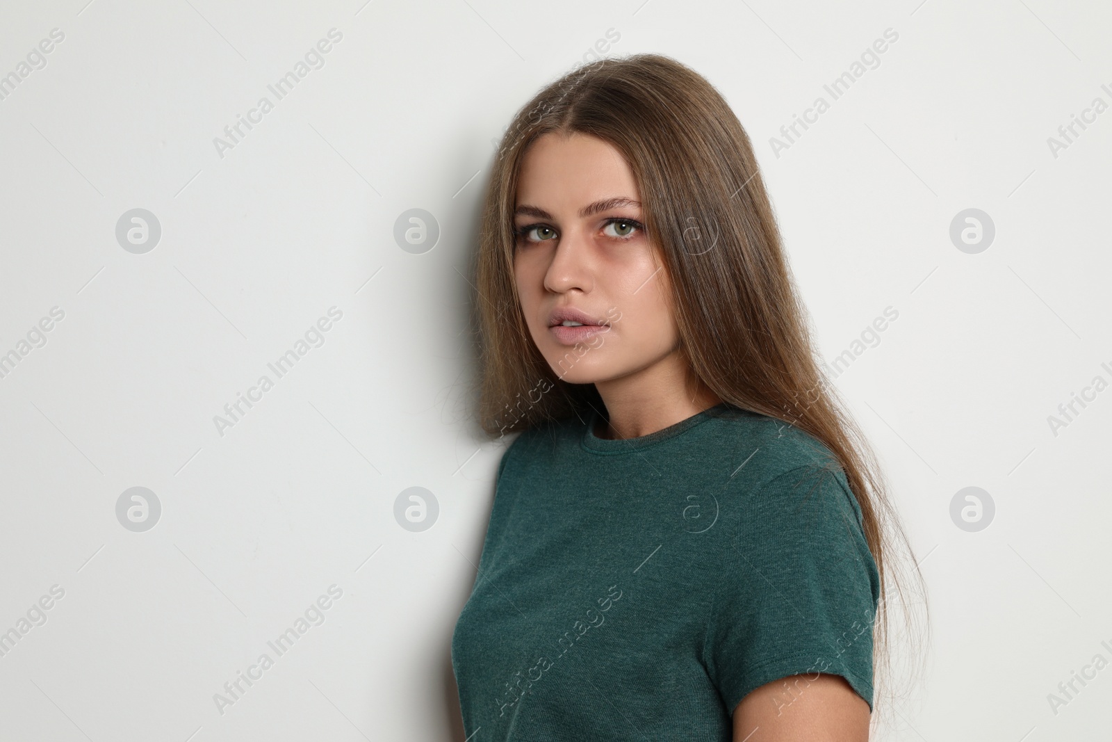 Photo of Portrait of abused young woman on light background. Stop violence