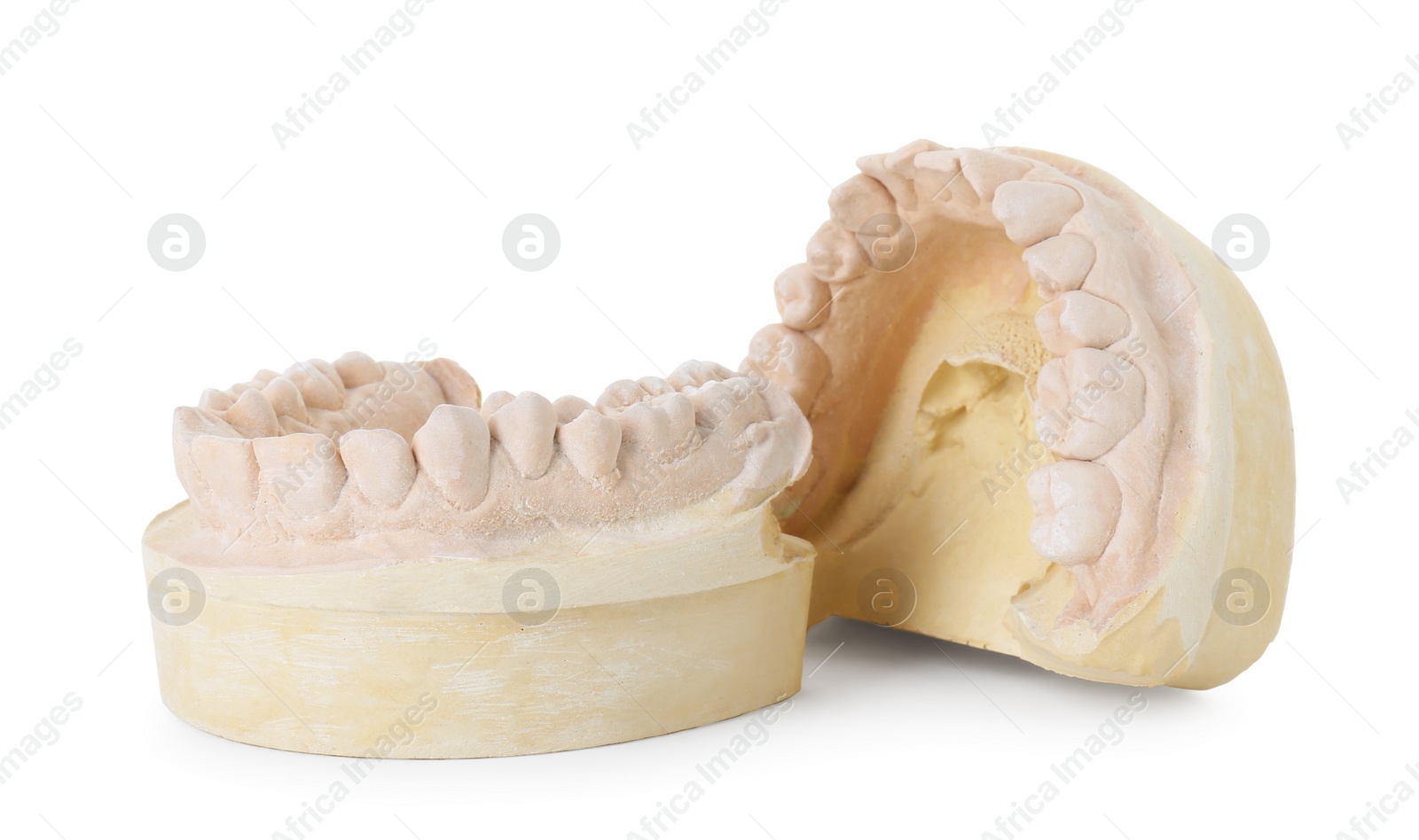 Photo of Dental model with jaws isolated on white. Cast of teeth